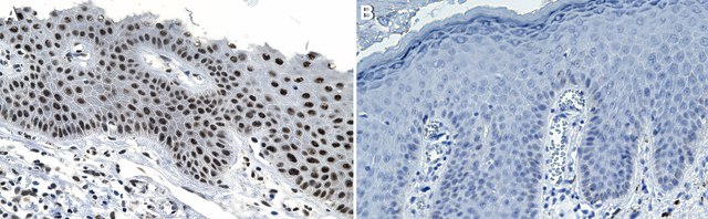 Anti-p-Ser/Thr-Pro MPM-2 Antibody, clone MPM-2 ZooMAb&#174; Mouse Monoclonal recombinant, expressed in HEK 293 cells