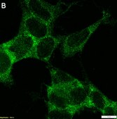 Anti-MEX3A Antibody, clone 1J23 ZooMAb® Rabbit Monoclonal recombinant, expressed in HEK 293 cells