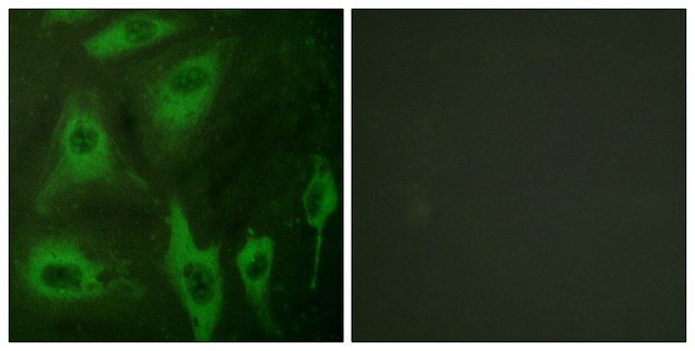 Anti-Aquaporin 2 antibody produced in rabbit affinity isolated antibody