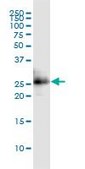 Monoclonal Anti-CITED1 antibody produced in mouse clone 6C1, purified immunoglobulin, buffered aqueous solution