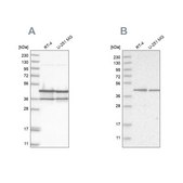 Anti-NUDC antibody produced in rabbit Prestige Antibodies® Powered by Atlas Antibodies, affinity isolated antibody, buffered aqueous glycerol solution, ab1