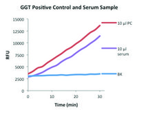 γ-Glutamyltransferase (GGT) Activity Fluorometric Assay Kit sufficient for 100 fluorometric&nbsp;tests