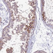 Anti-ITGAE antibody produced in rabbit Prestige Antibodies&#174; Powered by Atlas Antibodies, affinity isolated antibody, buffered aqueous glycerol solution