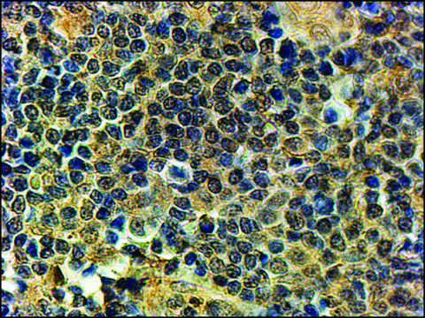 Anti-PRDM1 (C-terminal) antibody produced in goat affinity isolated antibody, buffered aqueous solution