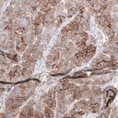 Monoclonal Anti-Msln Antibody Produced In Mouse Prestige Antibodies® Powered by Atlas Antibodies, clone CL13956, affinity isolated antibody, buffered aqueous glycerol solution