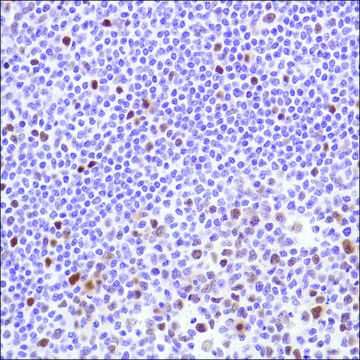 Anti-Cyclin D3 antibody, Rabbit monoclonal clone SP207, recombinant, expressed in proprietary host, affinity isolated antibody