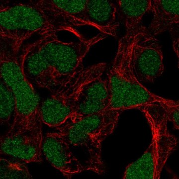 Anti-ADAMTS17 antibody produced in rabbit Prestige Antibodies&#174; Powered by Atlas Antibodies, affinity isolated antibody