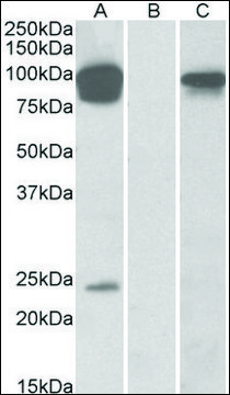 Anti-TRPV3 antibody produced in goat affinity isolated antibody, buffered aqueous solution