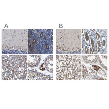 Anti-CLCC1 antibody produced in rabbit Prestige Antibodies&#174; Powered by Atlas Antibodies, affinity isolated antibody, buffered aqueous glycerol solution