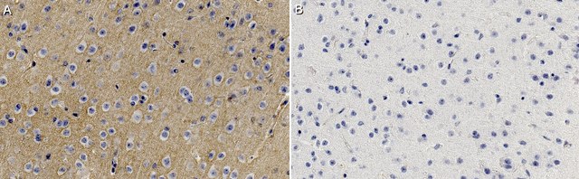 Anti-Tenascin-R Antibody, clone 23-14