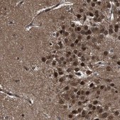 Anti-VCP antibody produced in rabbit Prestige Antibodies® Powered by Atlas Antibodies, affinity isolated antibody, buffered aqueous glycerol solution
