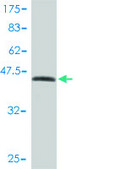 Monoclonal Anti-KRTHB1 antibody produced in mouse clone 3B10-5B10, purified immunoglobulin, buffered aqueous solution