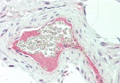 Anti-F13B antibody produced in rabbit affinity isolated antibody