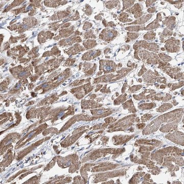 Anti-COMMD1 antibody produced in rabbit Prestige Antibodies&#174; Powered by Atlas Antibodies, affinity isolated antibody, buffered aqueous glycerol solution