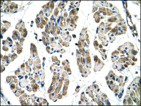 Anti-ITGB1BP2 antibody produced in rabbit IgG fraction of antiserum