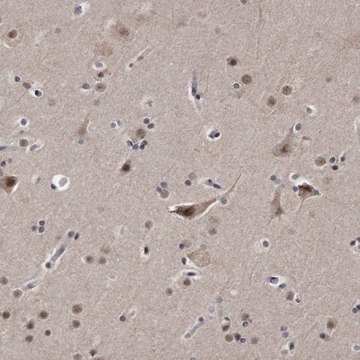 Anti-KLHDC3 antibody produced in rabbit Prestige Antibodies&#174; Powered by Atlas Antibodies, affinity isolated antibody, buffered aqueous glycerol solution, ab1