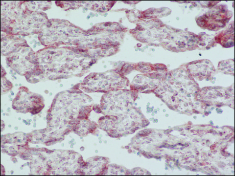 Anti-MR&#8722;Pro ADM antibody produced in rabbit