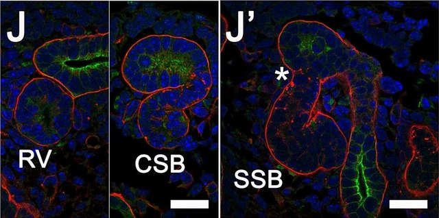 Monoclonal Anti-Cytokeratin, pan&#8722;FITC antibody produced in mouse clone C-11, purified immunoglobulin, buffered aqueous solution