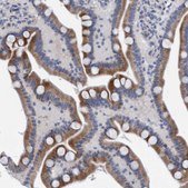 Anti-SLC28A3 antibody produced in rabbit Prestige Antibodies® Powered by Atlas Antibodies, affinity isolated antibody, buffered aqueous glycerol solution, Ab1