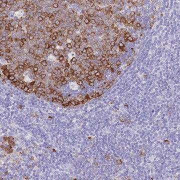 Anti-RRM1 antibody produced in rabbit Prestige Antibodies&#174; Powered by Atlas Antibodies, affinity isolated antibody, buffered aqueous glycerol solution