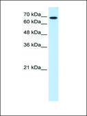 Anti-RPN2 antibody produced in rabbit affinity isolated antibody