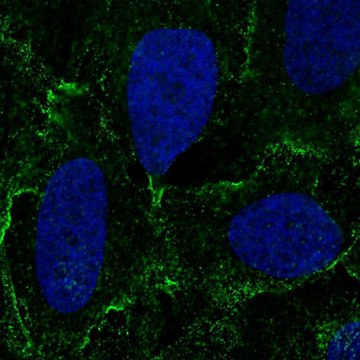 Anti-DSC3 antibody produced in rabbit Prestige Antibodies&#174; Powered by Atlas Antibodies, affinity isolated antibody