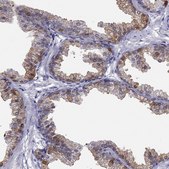 Anti-ALOX15B antibody produced in rabbit Prestige Antibodies® Powered by Atlas Antibodies, affinity isolated antibody