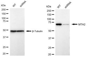 KD-Validated Anti Metastasis Associated 1 Family Member 2 Antibody, clone 24GB400, Rabbit Monoclonal clone 24GB400, recombinant rabbit monoclonal, expressed in HEK293 cells