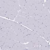Anti-GNLY antibody produced in rabbit Prestige Antibodies® Powered by Atlas Antibodies, affinity isolated antibody, buffered aqueous glycerol solution