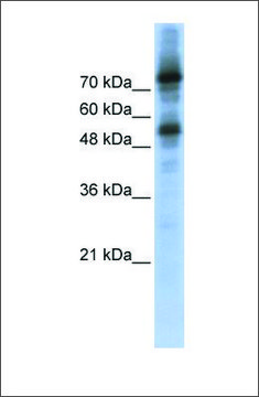 Anti-FOXM1 (ab2) antibody produced in rabbit affinity isolated antibody