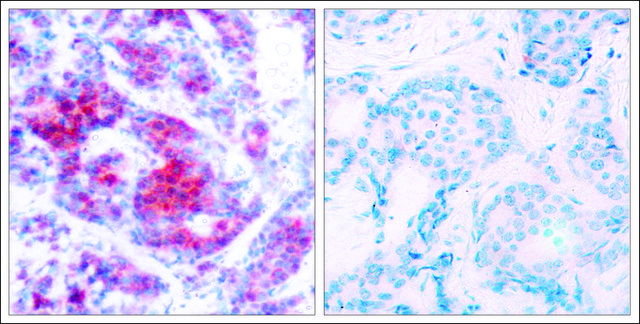 Anti-phospho-STAT4 (pTyr693) antibody produced in rabbit affinity isolated antibody