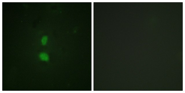 Anti-phospho-SNAI1 (pSer246) antibody produced in rabbit affinity isolated antibody