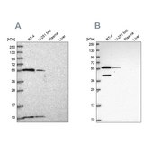Anti-NUP50 antibody produced in rabbit Prestige Antibodies® Powered by Atlas Antibodies, affinity isolated antibody, buffered aqueous glycerol solution