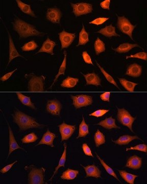 Anti- PHGDH antibody produced in rabbit