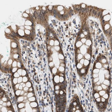 Anti-GIGYF1 antibody produced in rabbit Prestige Antibodies&#174; Powered by Atlas Antibodies, affinity isolated antibody, buffered aqueous glycerol solution, Ab1