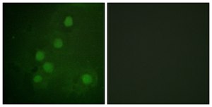 Anti-RAD52 antibody produced in rabbit affinity isolated antibody