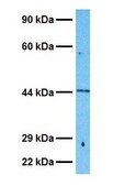 Anti-KRT19 (ab1) antibody produced in rabbit affinity isolated antibody