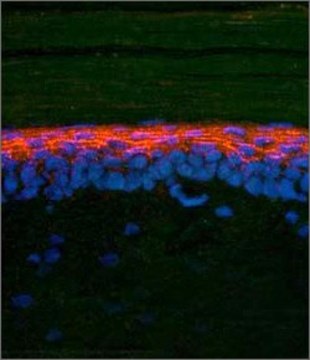 Anti-SMAD2, (N-terminal) antibody produced in rabbit affinity isolated antibody