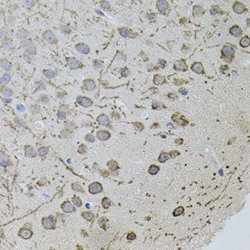 Anti-Androgen receptor antibody produced in rabbit