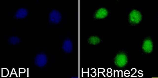 Anti-Symmetric DiMethyl-Histone H3-R8 antibody produced in rabbit