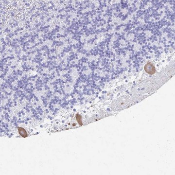 Anti-PRKCG antibody produced in rabbit Prestige Antibodies&#174; Powered by Atlas Antibodies, affinity isolated antibody, buffered aqueous glycerol solution