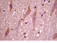 Anti-Neurogenin-3 Antibody, a.a. 80-93 of mouse Neurogenin-3. Chemicon®, from rabbit