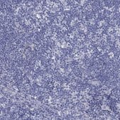 Anti-MLF1 antibody produced in rabbit Prestige Antibodies® Powered by Atlas Antibodies, affinity isolated antibody, buffered aqueous glycerol solution