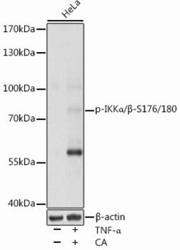 Anti-Phospho-IKK&#945;/&#946;-S176/180 antibody produced in rabbit