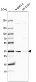 Anti-KCTD10 antibody produced in rabbit Prestige Antibodies® Powered by Atlas Antibodies, affinity isolated antibody, buffered aqueous glycerol solution