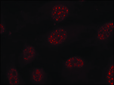 Anti-phospho-MAPKAPK2 (pThr334) antibody produced in rabbit affinity isolated antibody