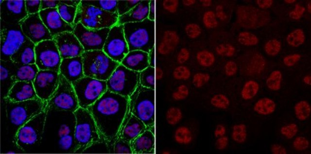 Anti-SKP1 Antibody, clone 3F3.1 clone 3F3.1, from mouse