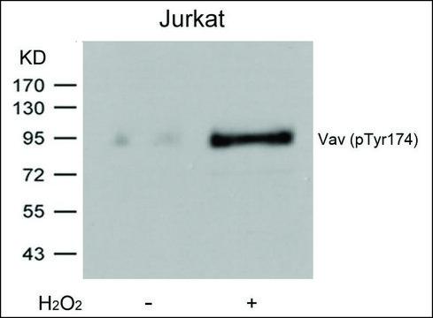 抗-磷酸化-VAV1 (pTyr174) 兔抗 affinity isolated antibody