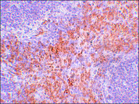 抗-RIPK1 兔抗 affinity isolated antibody, buffered aqueous solution