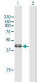 Anti-ACADM antibody produced in mouse purified immunoglobulin, buffered aqueous solution